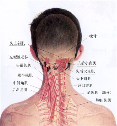 颈椎椎间盘突出的治疗方法介绍